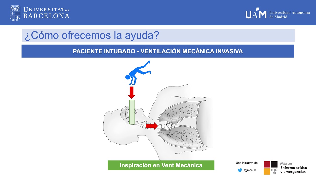 Modalidades Ventilatorias