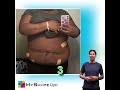 Only Lipo Front Of Abdomen Results Will Amaze You Shortsvideo 