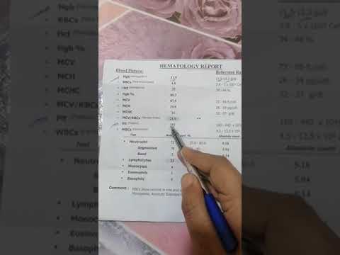 ازاى تقرأ التحاليل بسهولة تحليل صورة الدم الكاملة
