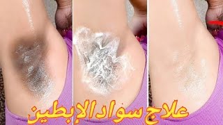 تفتيح المناطق السوداء فى الجسم من اول استعمال بالكريم السحرى | مضمون و مجربه 100%