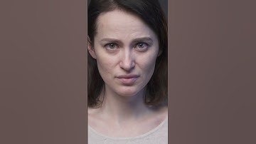 Cải thiện râu rồng - rãnh mũi má đẹp nhưng vẫn chuẩn nhân tướng #shorts