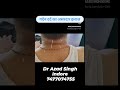 #neckpain #neck #cervical #indore #acupuncture #doctor #health #motivation #holistichealth