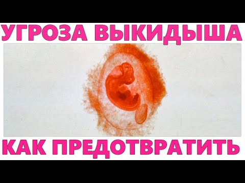 УГРОЗА ВЫКИДЫША | Как предотвратить угрозу выкидыша на ранних сроках и что делать при этом