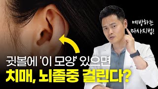 치매 뇌졸중 2배 넘게 예방하는 비법