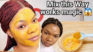 In 3 Days- Remove Pimples, Dark Spots And Acne,50 Look 20 After Using This