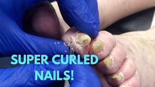 SUPER CURLED NAIL CARE!