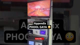 Swollen Appendix About to Burst ⚠️ Early Sign You Should NOT Ignore | Laparoscopic Surgery In Nashik