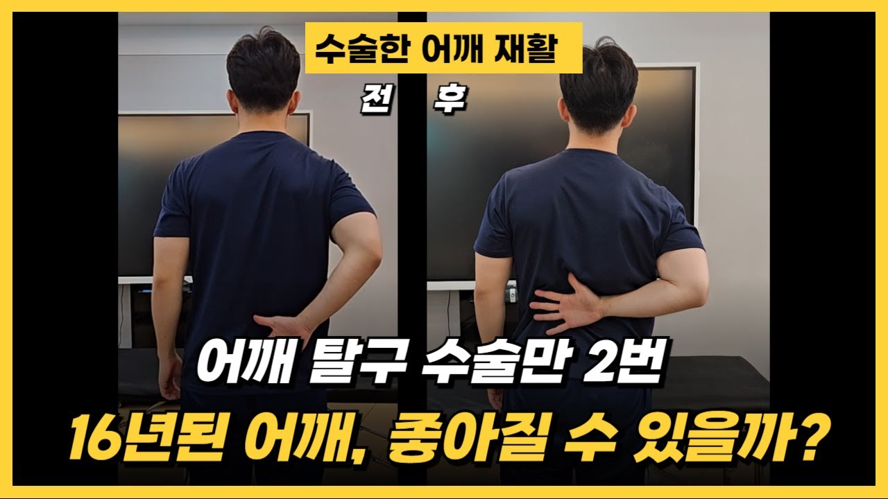 [어깨 재활] 탈구 수술만 2번, 어깨 아픈지 16년 됐습니다