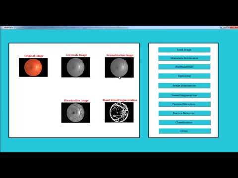 Final Year Project Image Processing | Final Year Project Image ...