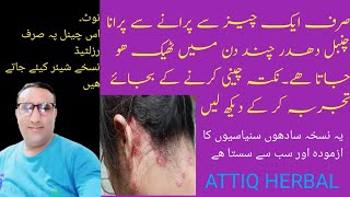 Sirf Aik Cheez Se Purani Chambal Dhader Ka Ilaj !! Psoriasis Ka Ilaj !! Attiqherbal