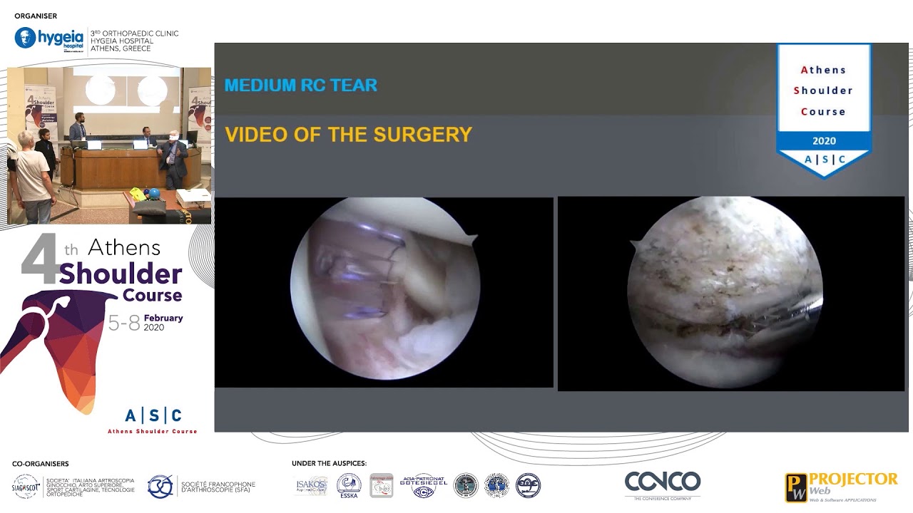 Rotator cuff: case presentation - YouTube