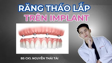 Răng Giả THÁO LẮP TRÊN IMPLANT - Lựa Chọn Cho Người Mất Răng Lâu Năm | Bác Sĩ Tài Tử Tế
