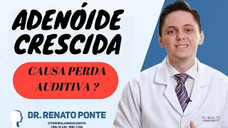 Adenóide Hipertrofiada causa perda auditiva ? I Dr. Renato Ponte Otorrinolaringologista