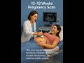 12 13 Weeks Scan Nuchal Translucency Baby S Growth Explained Babyscan Baby Babydevelopment 