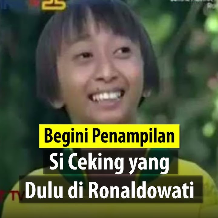 Masih Ingat dengan Si Ceking di Sinetron Ronaldowati? Lama Tak Terdengar, Kini Jadi DJ
