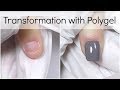 Short Bitten Nails Transformation with Polygel