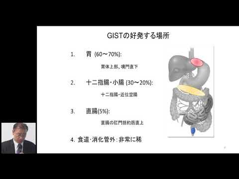 GIST（消化管間質腫瘍） GIST、或いは、その疑いと言われた時に知っておきたいこと～西田 俊朗～