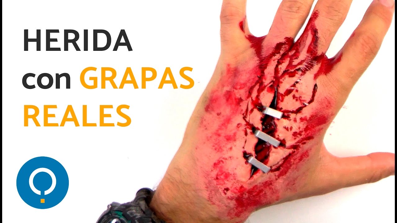 corte en la mano heridas falsa con l 225 tex corte en la mano con grapas corte en la mano heridas falsa con l 225 tex corte en la mano con grapas