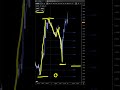 EURUSD Clearest Entry of the Week | Trade Example August 1