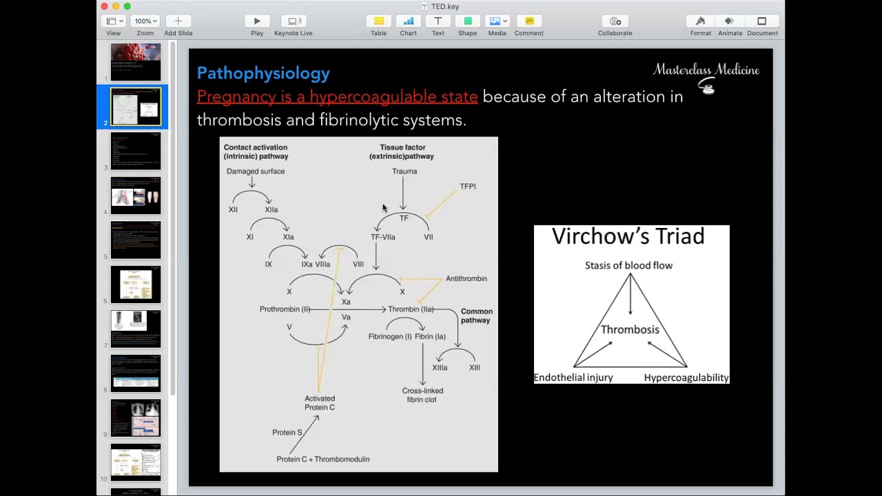 Venous Thromboembolism - OB course - Masterclass Medicine