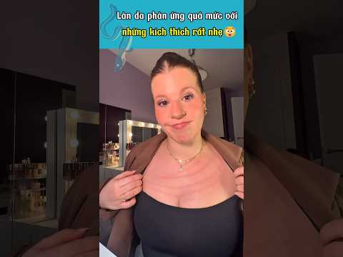 Video Nếu có thể vẽ lên da, có thể bạn đang gặp chứng da vẽ nổi 😲 - youtube