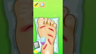 "Crazy Foot Doctor" gameplay screenshot 5