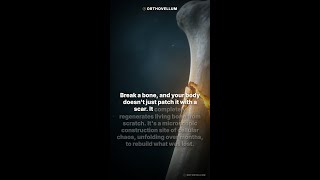 How Your Body Rebuilds a Broken Bone | Orthopaedic Biology