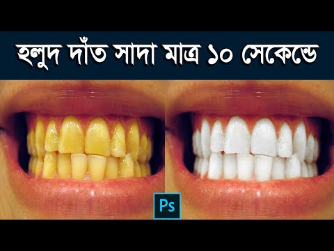 হলুদ দাঁত সাদা করুন মাত্র ১০ সেকেন্ডে | Whiten Teeth In Only 10 Second | Photoshop Bangla Tutorial