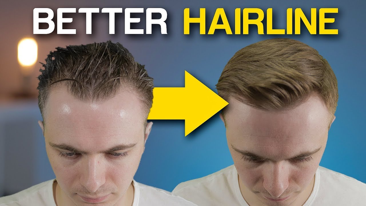 Hairstyle for Balding Men | CtgBay.com | Balding mens hairstyles, Bald men,  Haircuts for balding men