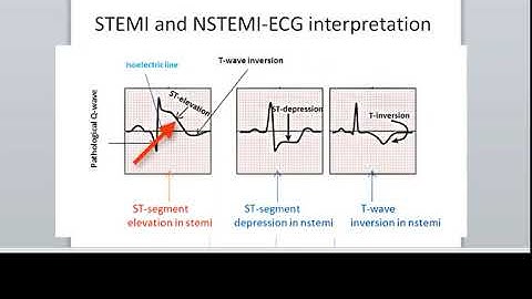 HIT220 221 Coding Handbook Chapter 27 Part 1 (This was Chapter 28 in earlier editions of the text.)