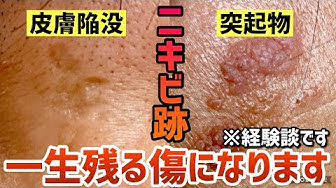 よこす Youtube よこす Youtube