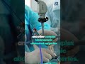 Advanced Laparoscopic Surgery for Safer &amp; Faster Recovery | ICI Multispeciality Hospital