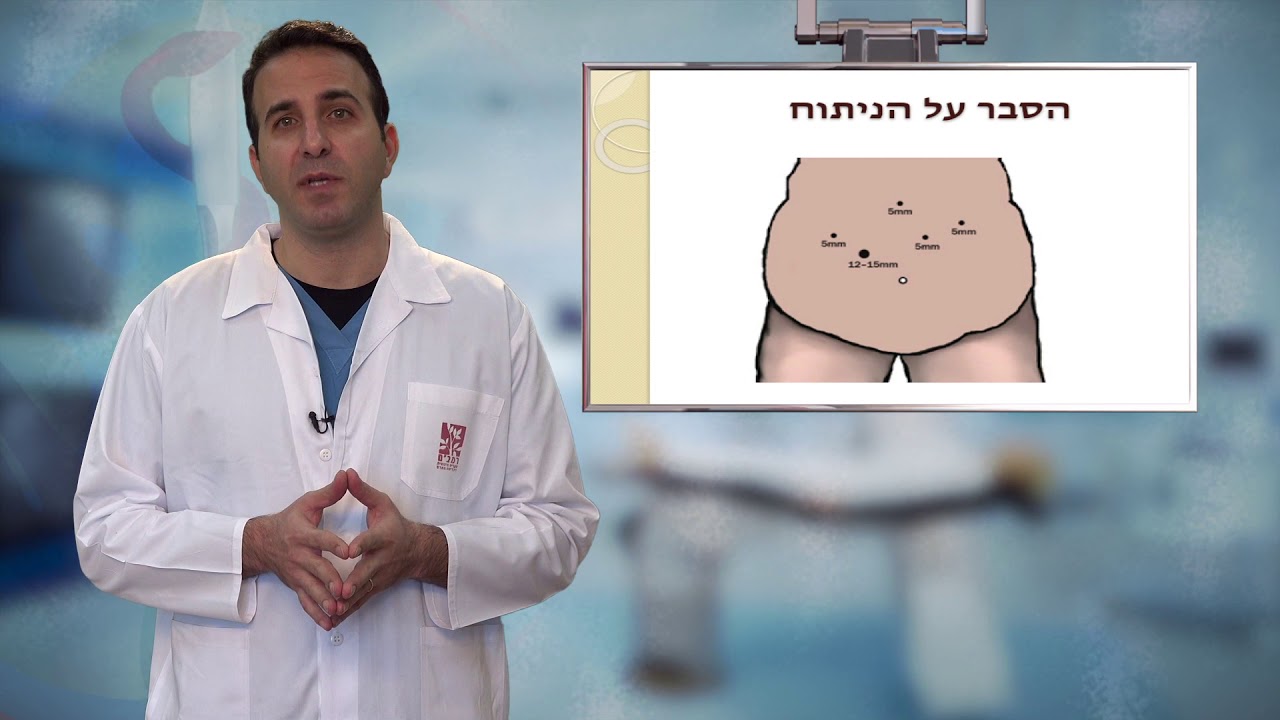 ניתוח מעקף קיבה - Gastric Bypass
