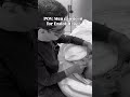 Endolift | Endolift X | Skin Tightening treatments | Skin lifting treatments | Sharp Jawline