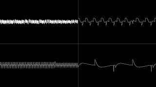 TransmissiOn/Off - (Fasttracker II)
