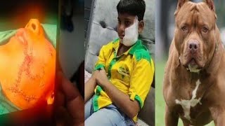 Small Boy Escapes from 3 Angry Dogs 😯1080p | How 2 Escape Its Very Hard | OMG DOGS & BOY |#games screenshot 3