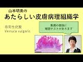 あたらしい皮膚病理組織学 尋常性疣贅 あたらしい皮膚病理組織学 尋常性疣贅