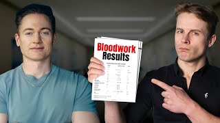 Download Lagu I Analyzed Bryan Johnson's Biomarkers and The Results Are... MP3 Download Lagu I Analyzed Bryan Johnson's Biomarkers and The Results Are... MP3