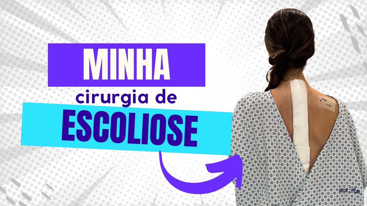 MINHA CIRURGIA DE ESCOLIOSE | Não senti dor