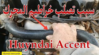 Comment les  durites  gonflent Huyndai Accent,  سبب الخراطيم تنتفخ وتتصلب هونداي أكسنت