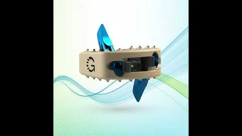 Genesys Spine: AIS C Stand Alone System