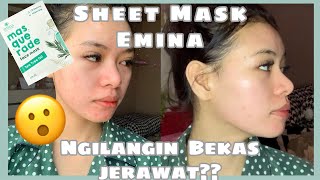 REVIEW SHEET MASK EMINAMASQUE RADE BISA HILANGIN JERAWAT DAN BEKASNYA | DALAM SEKALI PAKAI|