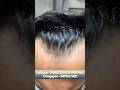 How we customise Hairline Patch|#hairpatch #hairreplacement #hairlosssolution#hair #kolkata#durgapur