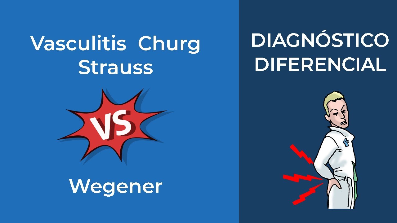 Diagnóstico Diferencial. Vasculitis Churg Strauss vs Wegener - YouTube