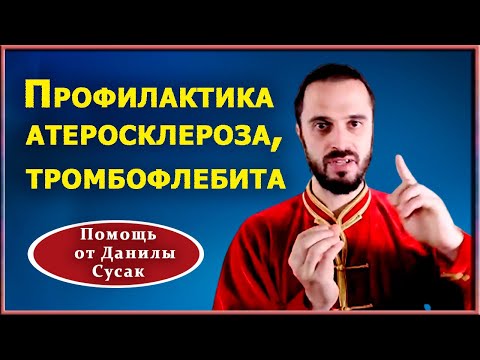 Разжижение крови,  профилактика атеросклероза и тромбофлебита.  Практические советы от Данилы Сусак