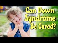 HOW TO CURE DOWN SYNDROME? Can this be done?