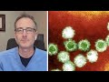 Its very contagious Doctor on norovirus and its symptoms