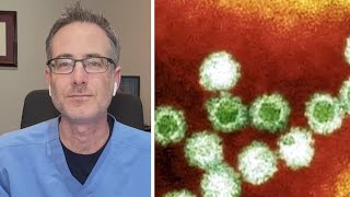 'It's very contagious': Doctor on norovirus and its symptoms