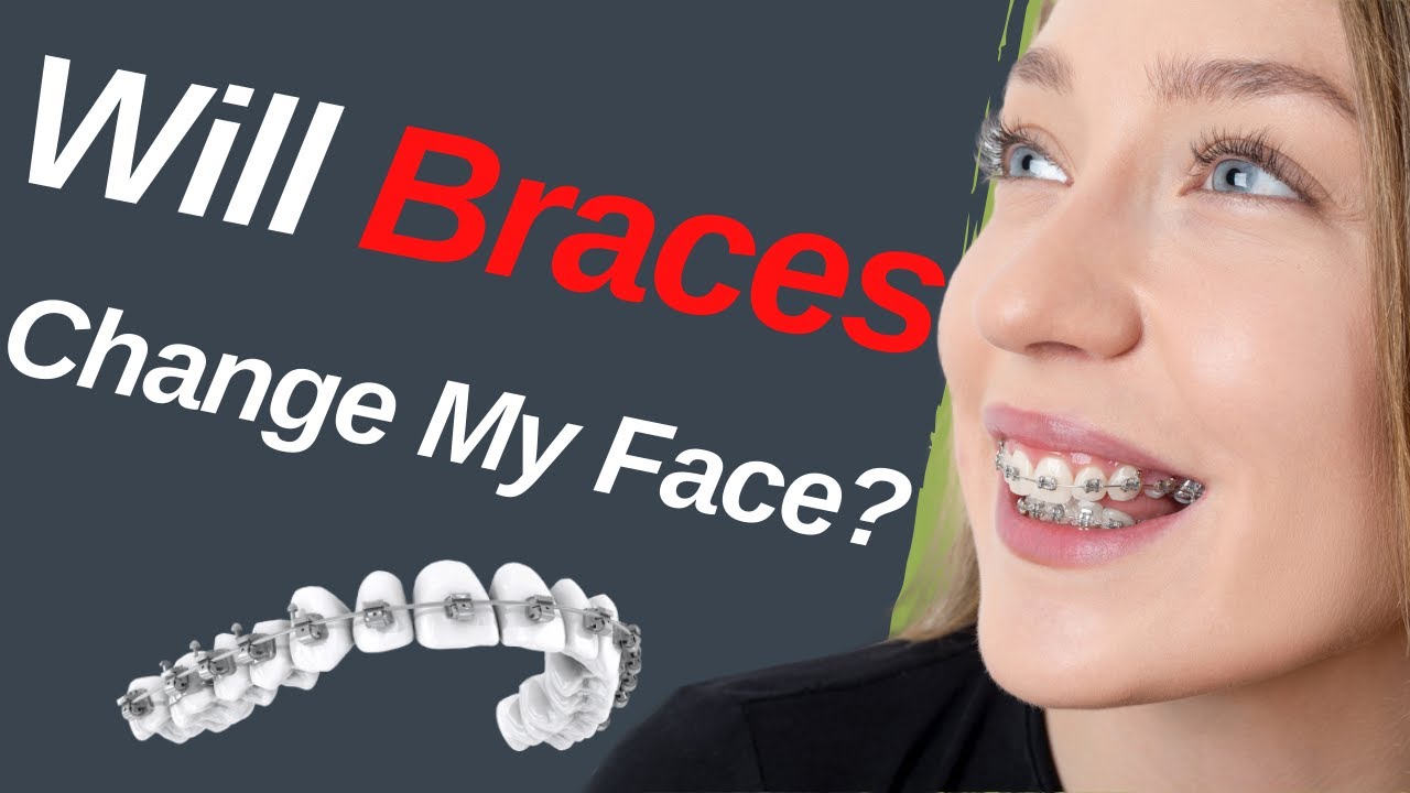 Young Age Play Braces