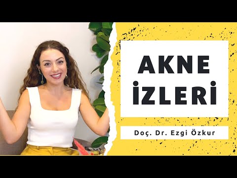 Sivilce İzleri Nasıl Geçer? Akne İzleri Tedavisi - Doç. Dr. Ezgi Özkur